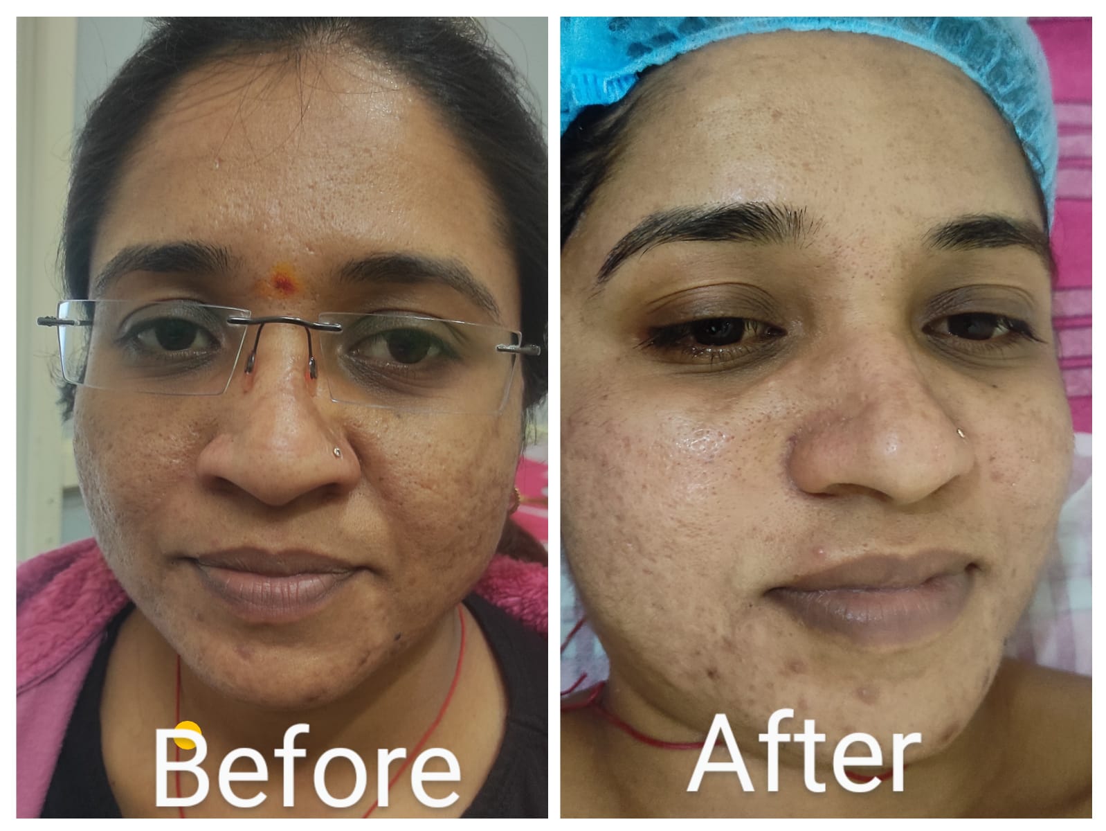 Treatment Result 2