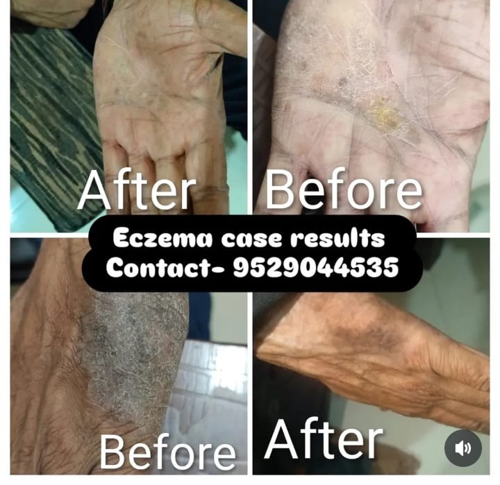 Treatment Result 6