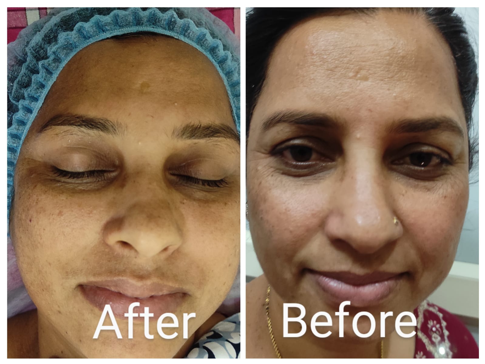 Treatment Result 8